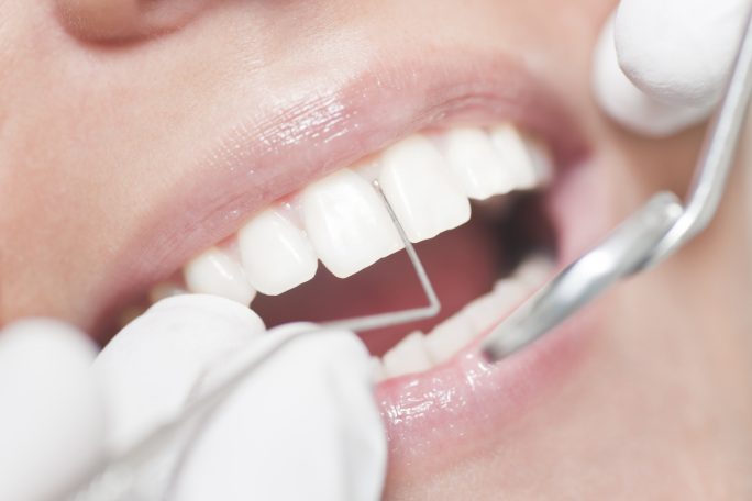 Periodoncia